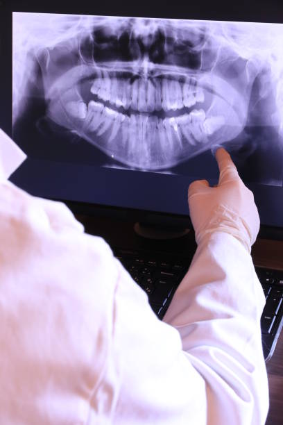 Best Emergency Tooth Extraction in Daingerfield, TX