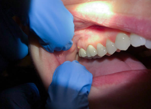 Best Same-Day Emergency Dental Services in Daingerfield, TX
