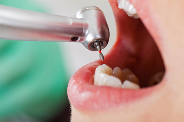Best 24-Hour Emergency Dentist in Daingerfield, TX